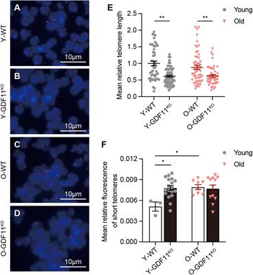 Loss of Growth Differentiation Factor 11 Shortens Telomere Length by Downregulating Telomerase Activity